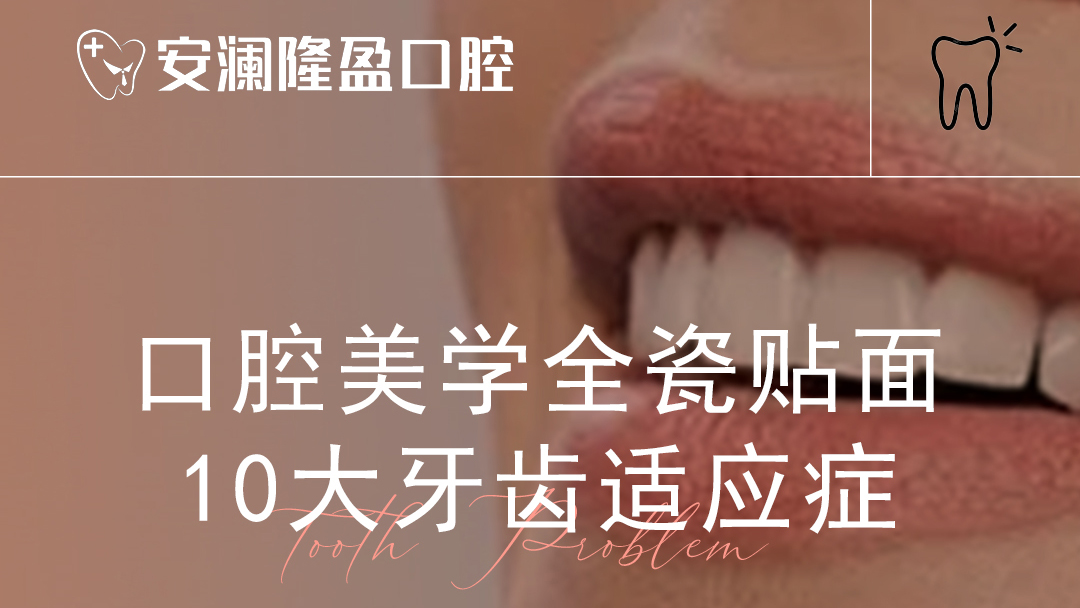 安澜口腔美学全瓷贴面10大牙齿适应症